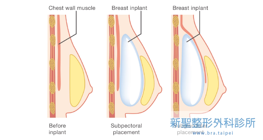 1637681875543830.jpg i1.jpg